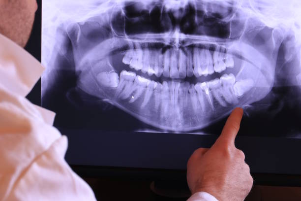 Best Root Canal Emergency Dentist  in St Marys, PA